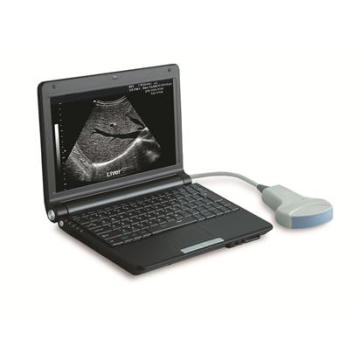 Laptop-Ultraschall-Scanner-PT3000d1